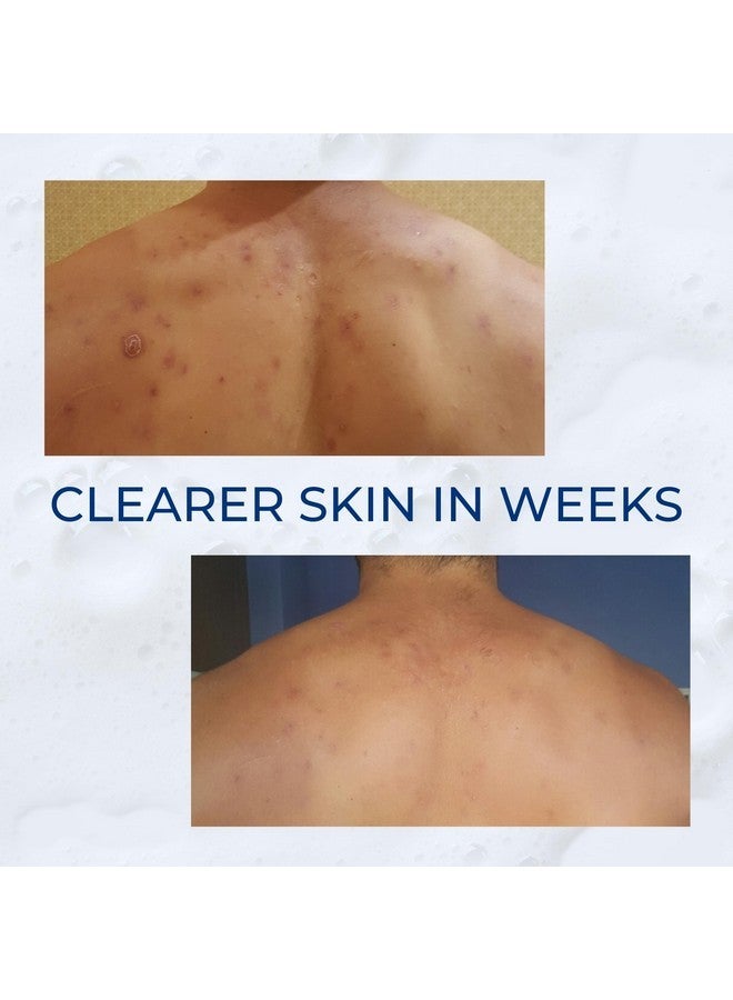 C2P Non-Comedogenic Clear 2 Perfection Shampoo - Sulfate & Paraben-Free for Clear, Healthy Skin & Hair - Esthetician Formulated - Image 3