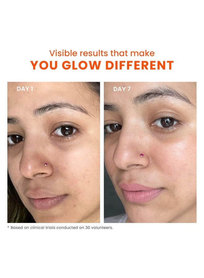 Foxtale SPF 70 Niacinamide Dewy Sunscreen with PA++++ For Dewy Sun Protection|Prevents Tan|Lightenweight, Non Greasy, No White Cast|Anti-Tan Formula|For Men & Women|For all skin type,50 Ml - Image 4