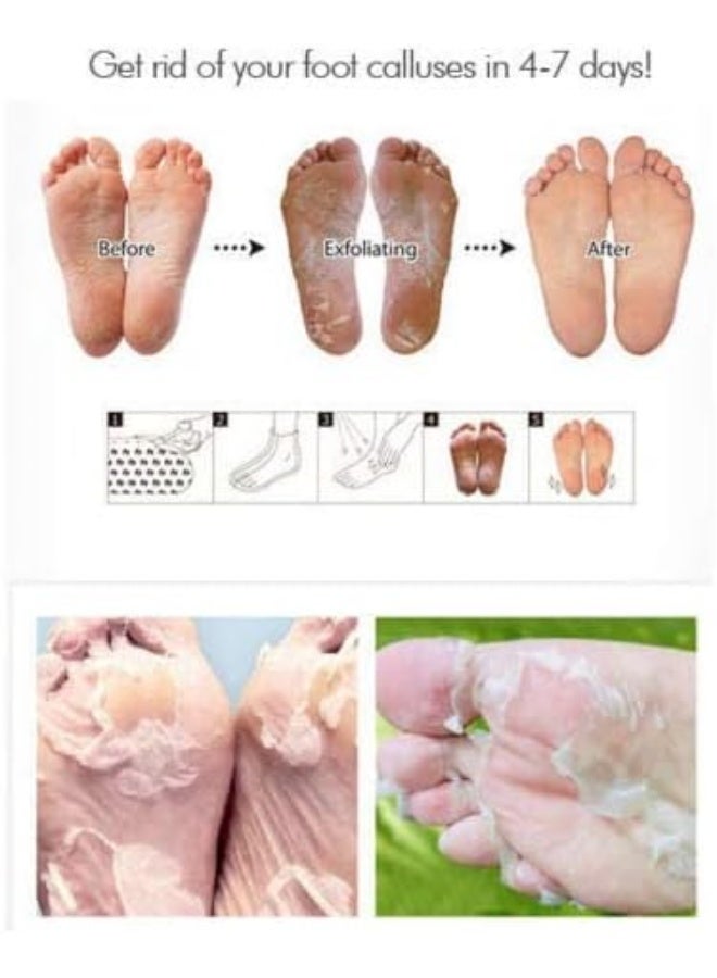 Purederm Exfoliating Foot Mask Peels Away Calluses And Dead Skin In 2 Weeks 5 Pack - Image 3