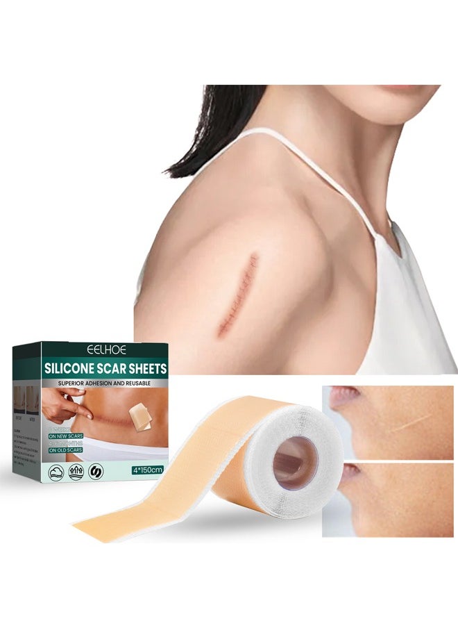 EELHOE - Silicone Scar Sheets (Scar Roll-4*150cm), Silicone Scar Tape, Reusable Silicone Scar Tape, Beauty Patch Scar Patch, Scar Removal Away Strips for Keloid, C-Section, Surgery, Burn, Acne et - Image 1