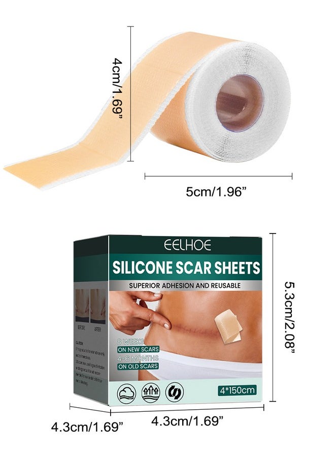 EELHOE - Silicone Scar Sheets (Scar Roll-4*150cm), Silicone Scar Tape, Reusable Silicone Scar Tape, Beauty Patch Scar Patch, Scar Removal Away Strips for Keloid, C-Section, Surgery, Burn, Acne et - Image 1