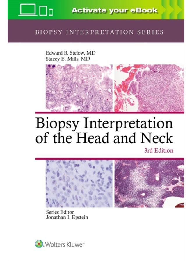 Biopsy Interpretation of the Head and Neck - Hardback