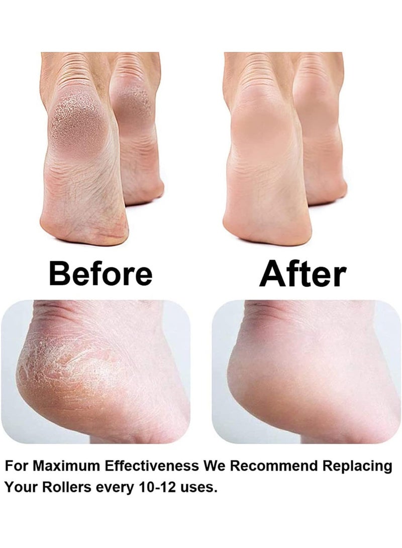 Kimaya Rechargeable Electric Callus Remover for Feet, Pedicure Foot Scrubber & Dead Skin Remover, Hard Skin & Cracked Heel Repair Tool with Foot Roller – Smooth & Soft Feet Care - Image 3
