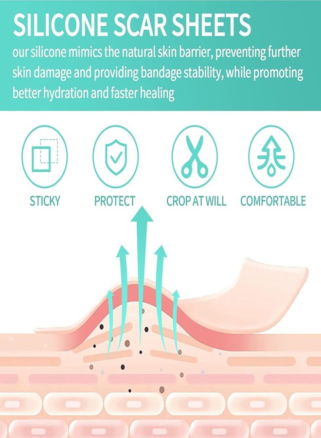 DPISZONE Silicone Scar Sheets, Silicon gel sheets for Scars Transparent Medical Silicone Gel Tape for Scar Removal, Silicone Scar Tape Roll For Hypertrophic Scars and Keloids Caused by Surgery - Image 3