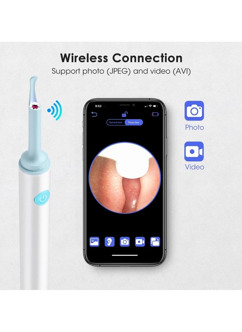 Ear Cleaning Tool With Endoscope Camera Earwax Removal Helper Connect To The Camera Via Wi-Fi On Your Mobile Device Earwax Purifier And Remover Black Color