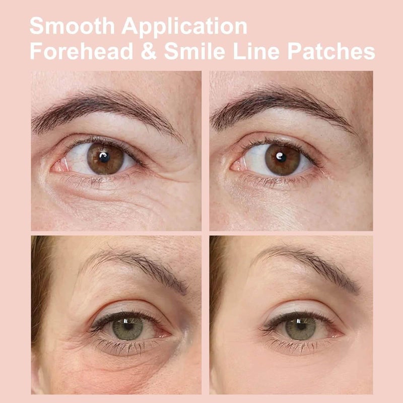 NOVALIFT Kunnozz Micro Eye Patches, Under Eye Patch for Puffy Eyes and Dark Circles, Smile Line Patches, Forehead Hydrating Anti-Wrinkle Masks for Women, 2 Boxes (3 Pairs Each) - Image 5