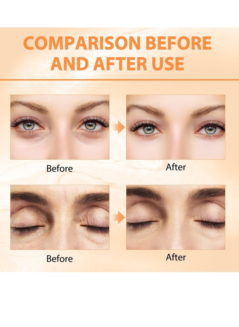 إيلهو 2 قطعة بلسم العين Revive Glow Vitamin C ، كريم مرطب للعين ، تحسين الهالات السوداء ، يضيء لون البشرة للانتفاخ ويقلل من الخطوط الدقيقة  - Image 4