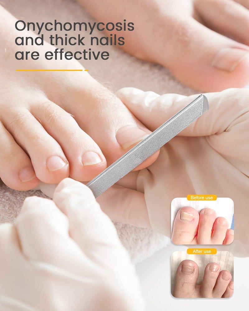 BEZOX Long Metal Nail File, Stainless Steel Fingernail File for Thick and Fungal Nails with Dual-Ended Toenail Lifter â€“ The Ultimate Manicure & Pedicure Tool for Men and Womenâ€™s Nail Care - Black - Image 3