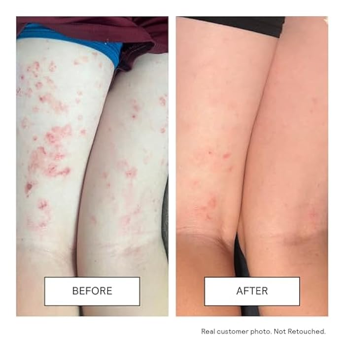 Untoxicated Moisturizing Cream - Facial Moisturizer & Body Cream for Sensitive Skin and NEA Approved for Eczema Relief - Ceramides & Hyaluronic Acid with No Common Irritants - Image 5