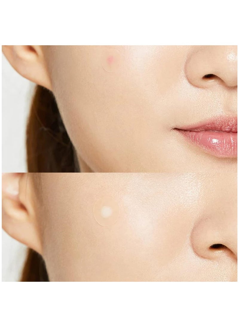 EELHOE PACKAGEإزالة ندبات حب الشباب وعلامات تمدد بشرة الوجه وتقليص المسام - Image 2