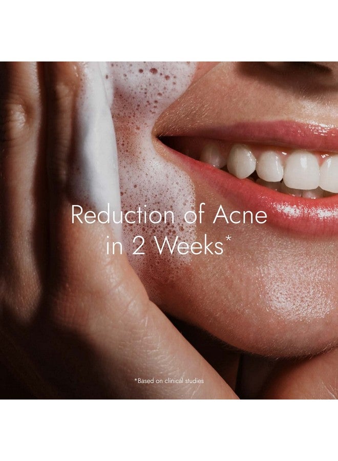 Kapiva Acne Control Tulsi Face Wash | Reduces Active Acne & Scars | For All Skin Types | 0% Parabens, Sulfates, Silicones - Image 2