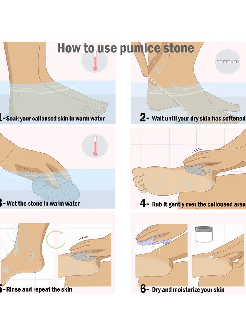 Excefore Pumice Stone, Callus Remover for Hard and Dead Skins, Foot Scrubber & Pedicure Tools for Men & Women Feet  2Pcs - Image 4