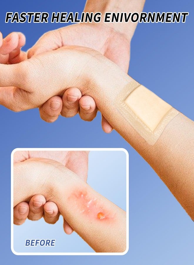 CAREUS ضمادات لاصقة من السيليكون والرغوة من Careus e ذات حواف ناعمة، 4 بوصات × 4 بوصات، عبوة من 10 ضمادات، ضمادات جروح رغوية عالية الامتصاص لقرح الفراش - Image 5