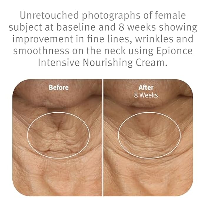 Epionce Intensive Nourishing Cream – Rich Anti-Aging Moisturizer for Face, Neck & Décolletage | Ceramides, Glycerin & Squalene | Targets Fine Lines, Dark Spots & Dryness | Dermatologist Skincare - Image 4