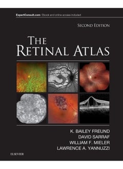 The Retinal Atlas 