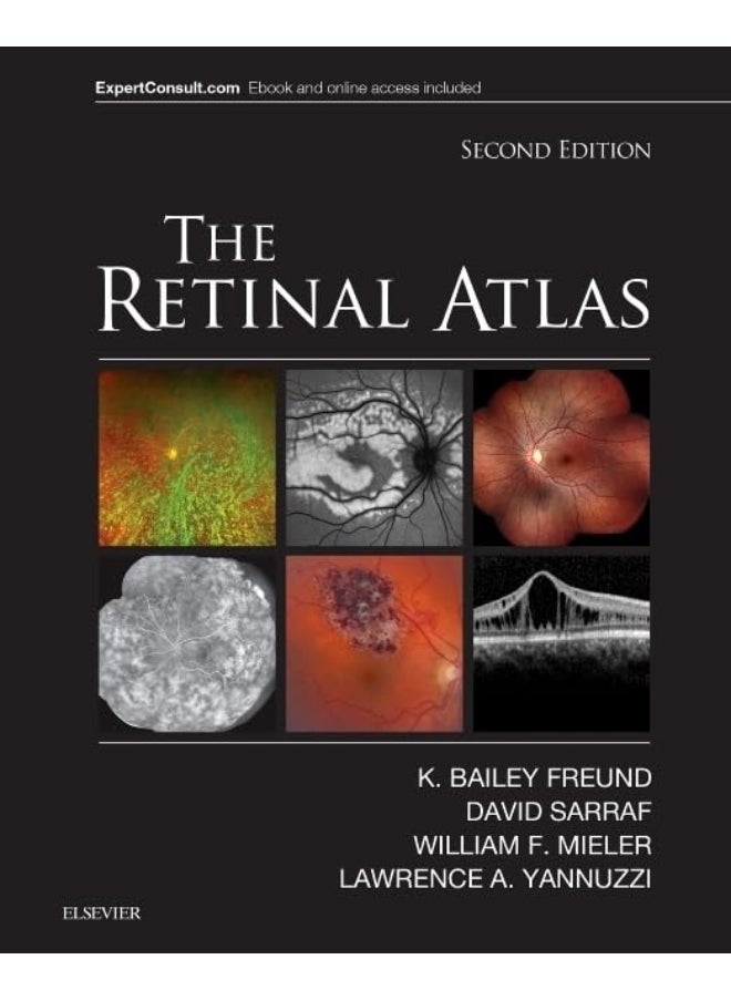 null - The Retinal Atlas - Image 1