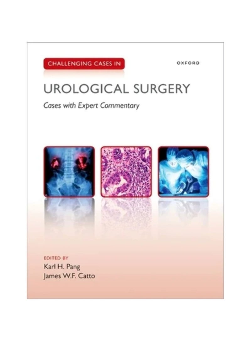 Challenging Cases In Urological Surgery Cases With Expert Commentary Paperback 
