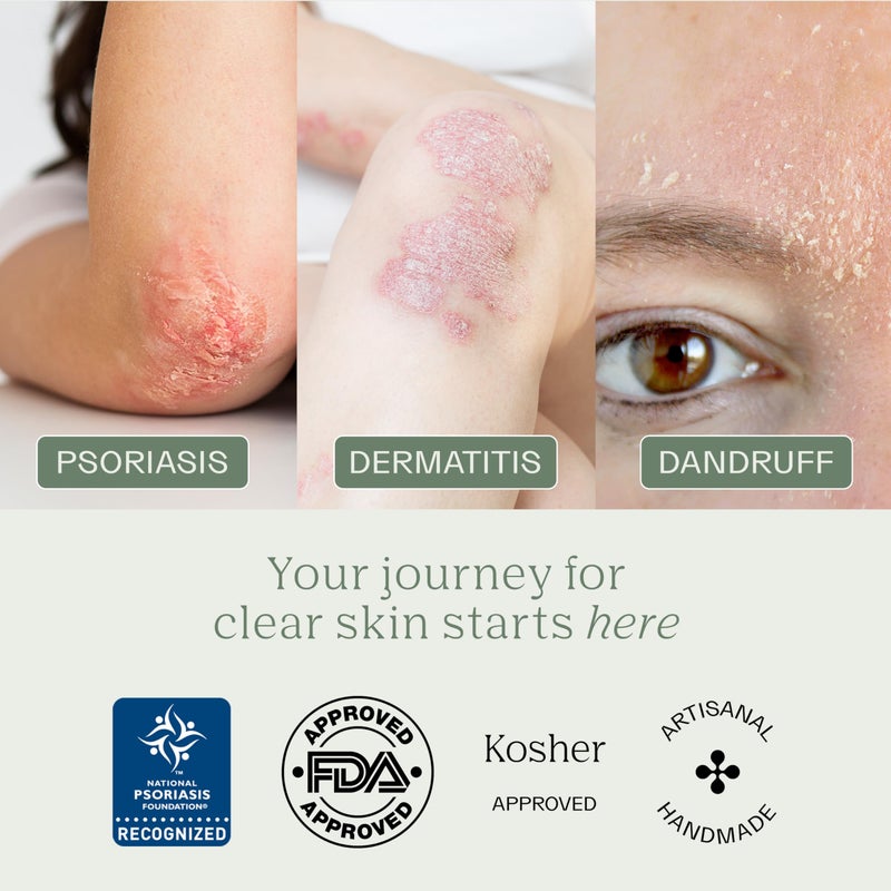 Dermabon Psoriasis Cleanser, Seborrheic Dermatitis & Eczema Soap Bar for Adults - 2% Coal Tar Soap Active Ingredient - Soothes Itching, Reduces Inflammation, Moisturizes Skin,Gentle Daily Use - 3 Pack - Image 4