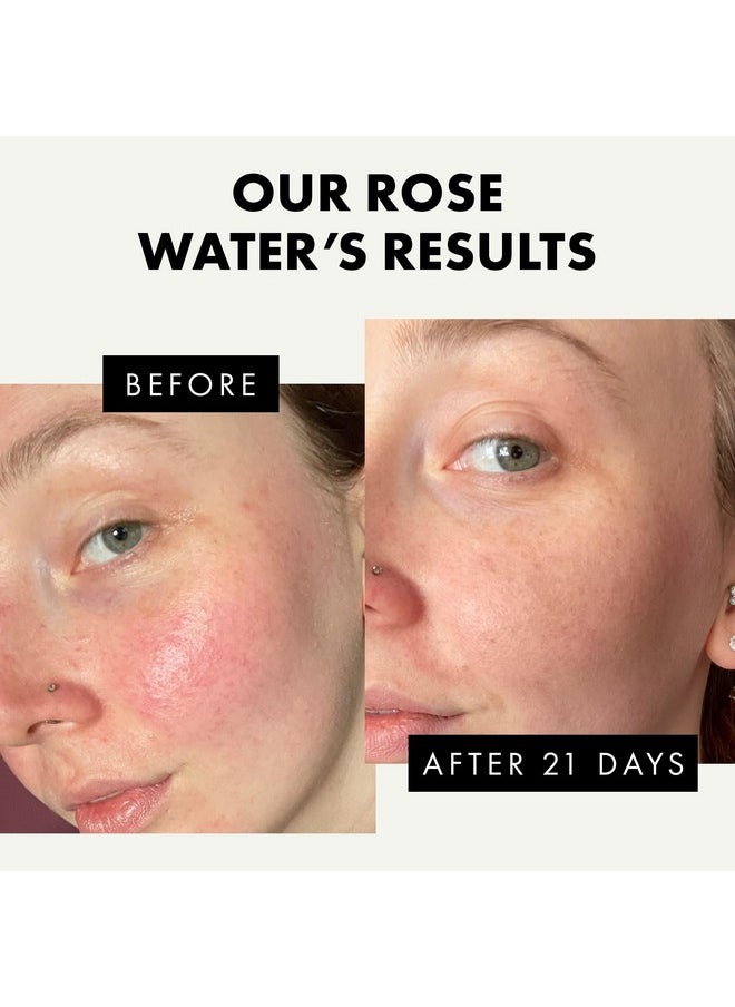 Eclat Skincare Rose Water Facial Toner Organic Rosewater Toner Spray For Face Pore Minimizer Hydrating Toner Face Mist Pure Rose Water Toner For Dry Skin 100% Rose Water For Hair And Skin Face Toner For Women  - Image 4