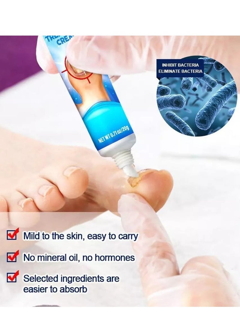 سوميفون كريم علاج فطريات الأظافر يعزز نمو الأظافر ويحسن مظهر الأظافر المتقدمة في السن، عناية مغذية بالأظافر وتخفيف آلام الأظافر، كريم إصلاح الأظافر 20 جرام - Image 2