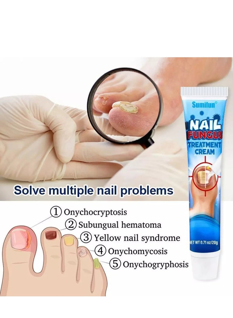 سوميفون كريم علاج فطريات الأظافر يعزز نمو الأظافر ويحسن مظهر الأظافر المتقدمة في السن، عناية مغذية بالأظافر وتخفيف آلام الأظافر، كريم إصلاح الأظافر 20 جرام - Image 3