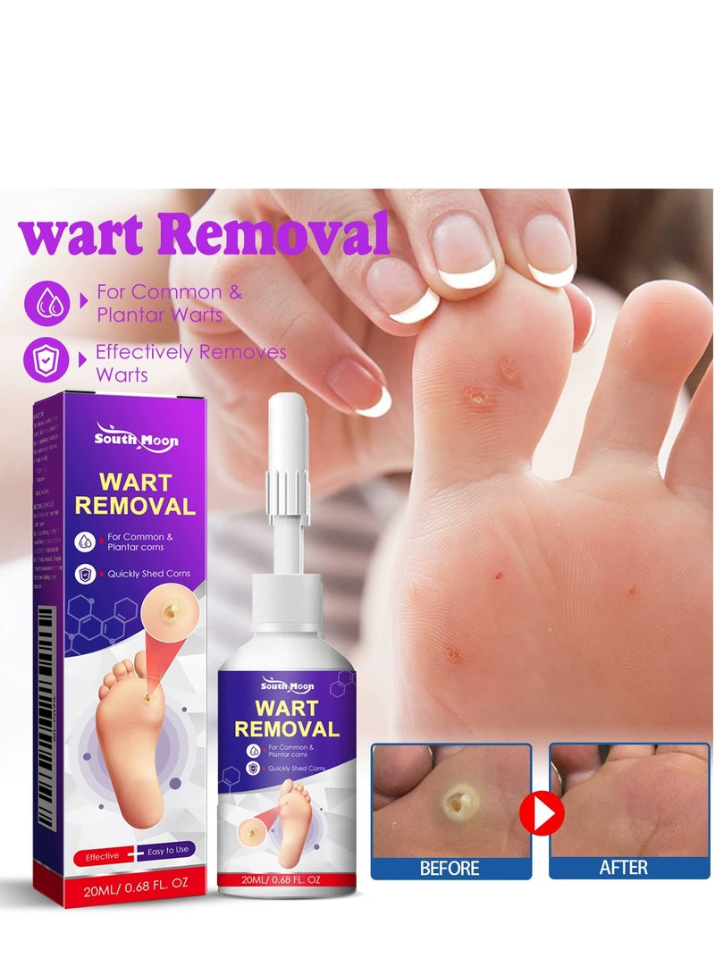 SOUTH MOON Liquid Wart & Corn Remover (20ml), Fast-Acting Salicylic Acid Formula for Plantar, Common, and Flat Warts – Effective Corn Removal for Feet, Toes, Fingers, and Hands – Freeze Off Wart - Image 2