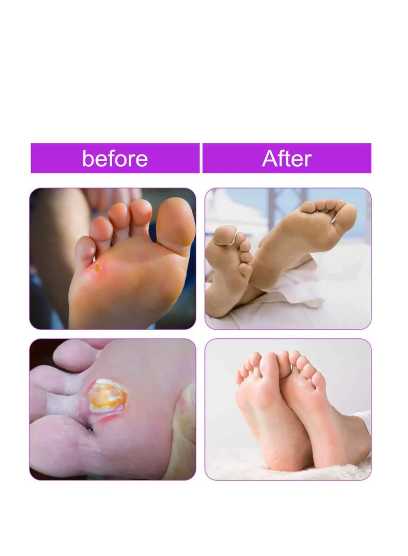SOUTH MOON Liquid Wart & Corn Remover (20ml), Fast-Acting Salicylic Acid Formula for Plantar, Common, and Flat Warts – Effective Corn Removal for Feet, Toes, Fingers, and Hands – Freeze Off Wart - Image 5