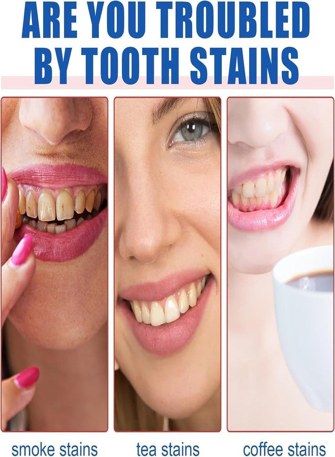 New Sp-6 Toothpaste, Brightening & Stain Removing sp-6 probiotic whitening toothpaste, Teeth Whitener Toothpaste, Natural Tooth Whitener (1Pcs) - Image 2