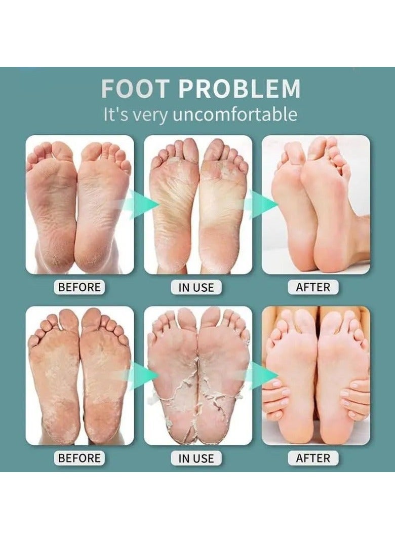 20 ml Foot Fungus Spray, Athlete's Foot Spray, Antibacterial Foot Spray, Antifungal Foot Spray, Foot Odor Spray, Deep Bacteriostasis Foot Spray Kills Fungus, Eliminates Odor - Image 3