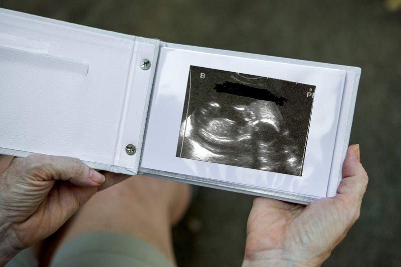 The Grandparent Gift Co. Pregnancy/Maternity Ultrasound And Photo Album/Keepsake - Image 2