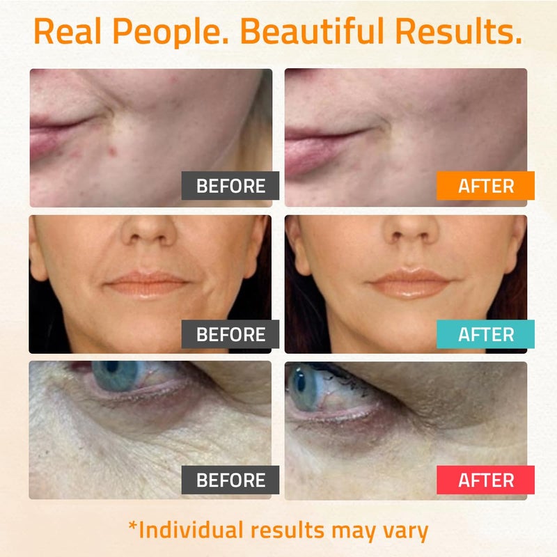 YEOUTH Skin Care Set: Retinol Serum for Face, Vitamin C and Hyaluronic Acid Serum, Face Care Kit that Targets Appearance of Uneven Uneven Skin and Dryness 3x1 oz - Image 4