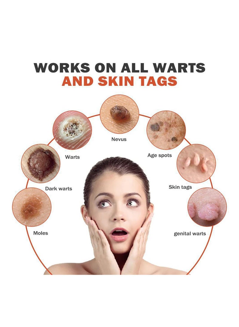 SYOSI Bee Venom Wart and Tag Removal Cream, Gentle Skin Treatment for All Skin Types, Easy to Apply and Non-Irritating, Effective Bee Venom Solution for Warts, Skin Tags, and Blemishes, Safe Daily Use  - Image 2