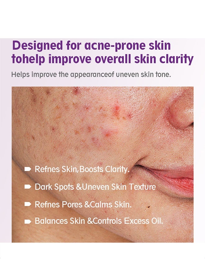 West&Month 12% Azelaic Acid Serum, Hyaluronic Acid & Niacinamide for Redness Relief Face, Dark Spot, Rosacea Acne, Balance Excess Sebum, Brightening Serum for All Skin Types 20g - Image 3