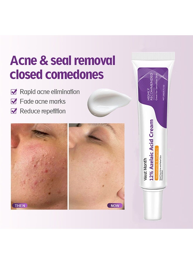 West&Month 12% Azelaic Acid Serum, Hyaluronic Acid & Niacinamide for Redness Relief Face, Dark Spot, Rosacea Acne, Balance Excess Sebum, Brightening Serum for All Skin Types 20g - Image 2