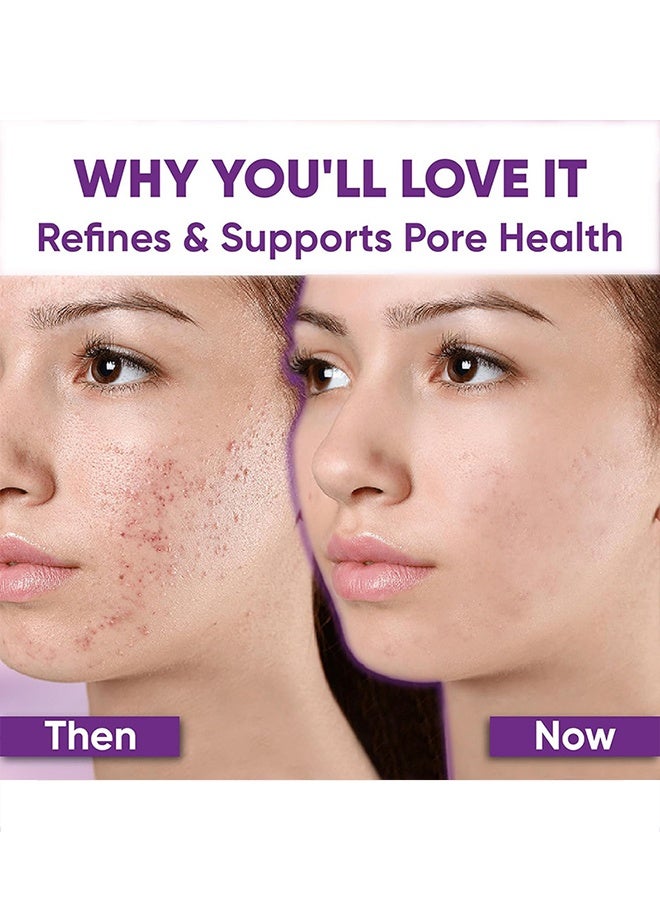 West&Month 12% Azelaic Acid Serum, Hyaluronic Acid & Niacinamide for Redness Relief Face, Dark Spot, Rosacea Acne, Balance Excess Sebum, Brightening Serum for All Skin Types 20g - Image 5