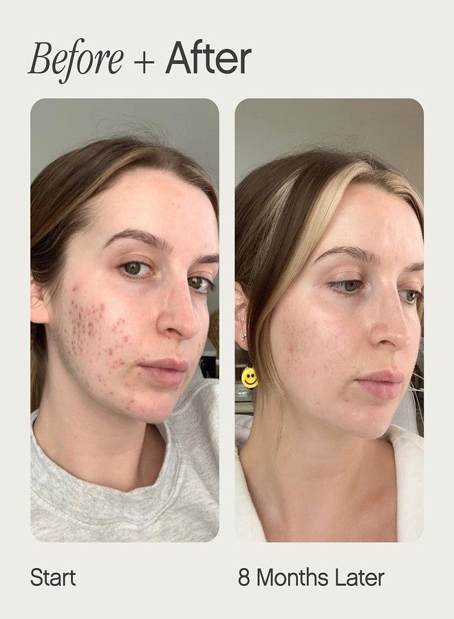 Topicals, Post-Acne Kit, Mini Faded Serum & Sealed Active Primer - Image 3