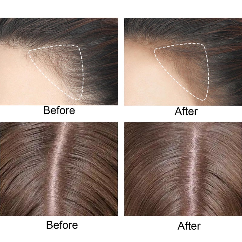 Rosarden عصا مسحوق الشعر - تخفي تساقط الشعر، لمسة جذر مقاومة للماء للشعر الرقيق، بقع صلع للنساء والرجال (بني) - Image 3