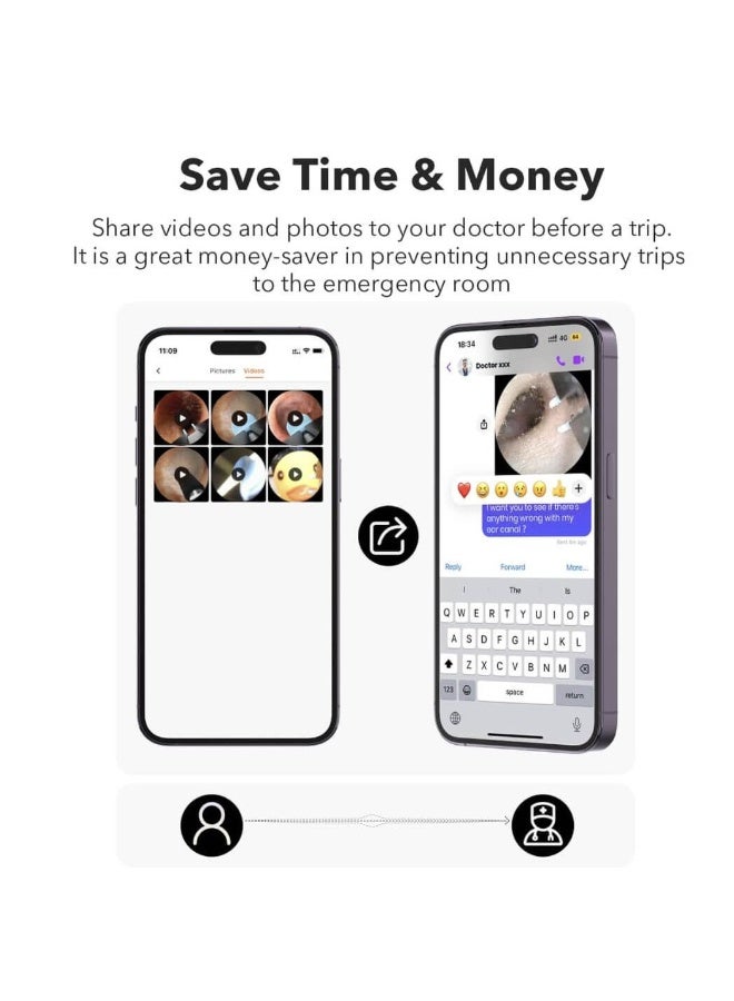 Bebird M9 S Smart Visual Ear Cleaner with 10MP Camera – 1080P HD Earwax Removal Tool with App Control - Image 3