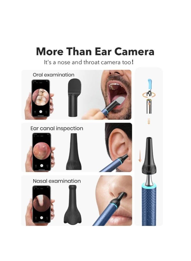 Bebird M9 S Smart Visual Ear Cleaner with 10MP Camera – 1080P HD Earwax Removal Tool with App Control - Image 2