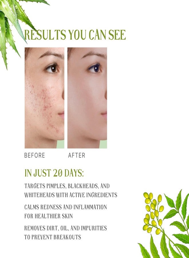 CAMISTA Anti Acne Face Wash with Neem & Aloe Vera Extract - 200 ml|Sebum Control & Excess Oil Removal|Pimple Clear Solution for Acne Prone Skin|Eliminates 99.9% Bacteria - Image 3