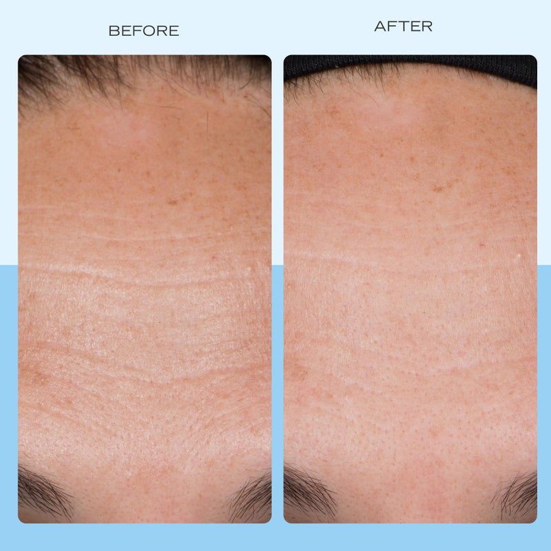 First Aid Beauty - Firming Collagen Cream with Peptides & Niacinamide, Ultra-Rich Plumping Moisturizer, Hydrates & Visibly Firms, Non-Comedogenic, Safe for Sensitive Skin, 3.5 oz - Image 3