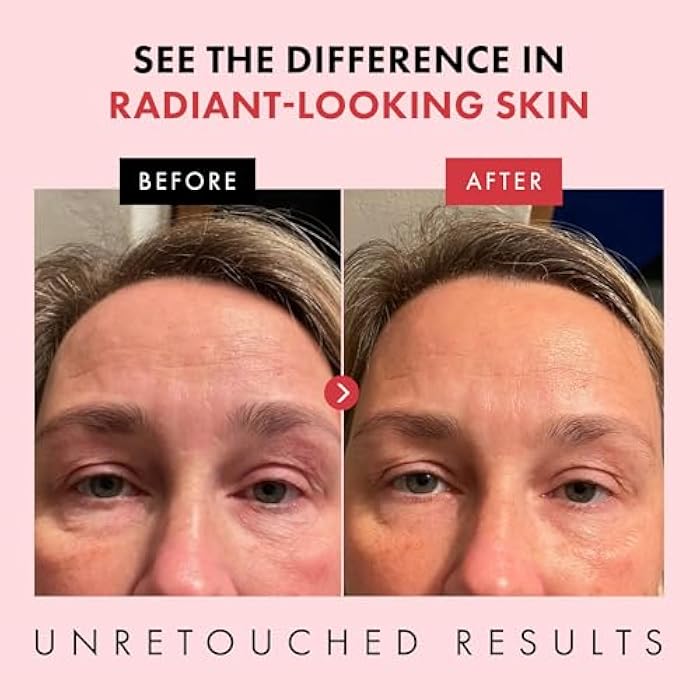 Eclat Skincare Retinol Night Cream – Renewing Retinol Cream for Face with Hyaluronic Acid – Anti Aging to Smooth Wrinkles & Fine Lines - Firming & Hydrating Face Moisturizer for Women & Men 50 ml - Image 3