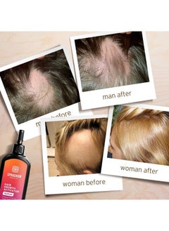 Sphagnum Botanicals Hair Growth Serum Follicle Activator Treats 5 Main Causes For Hair Loss. Cleanses And Nourishes Roots. 1.7 Oz  - Image 5