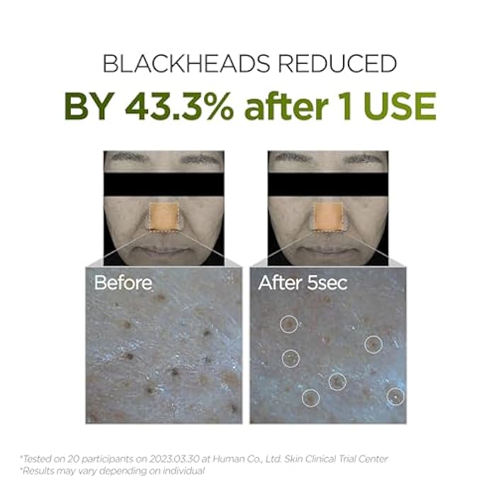 P.CALM Underpore Holy Basil Cleansing Oil – Holy Basil & Tea Tree for Deep Pore Cleansing, Blackhead Removal, and Makeup Removal, Korean Skincare (190ml / 6.42 fl.oz) - Image 5