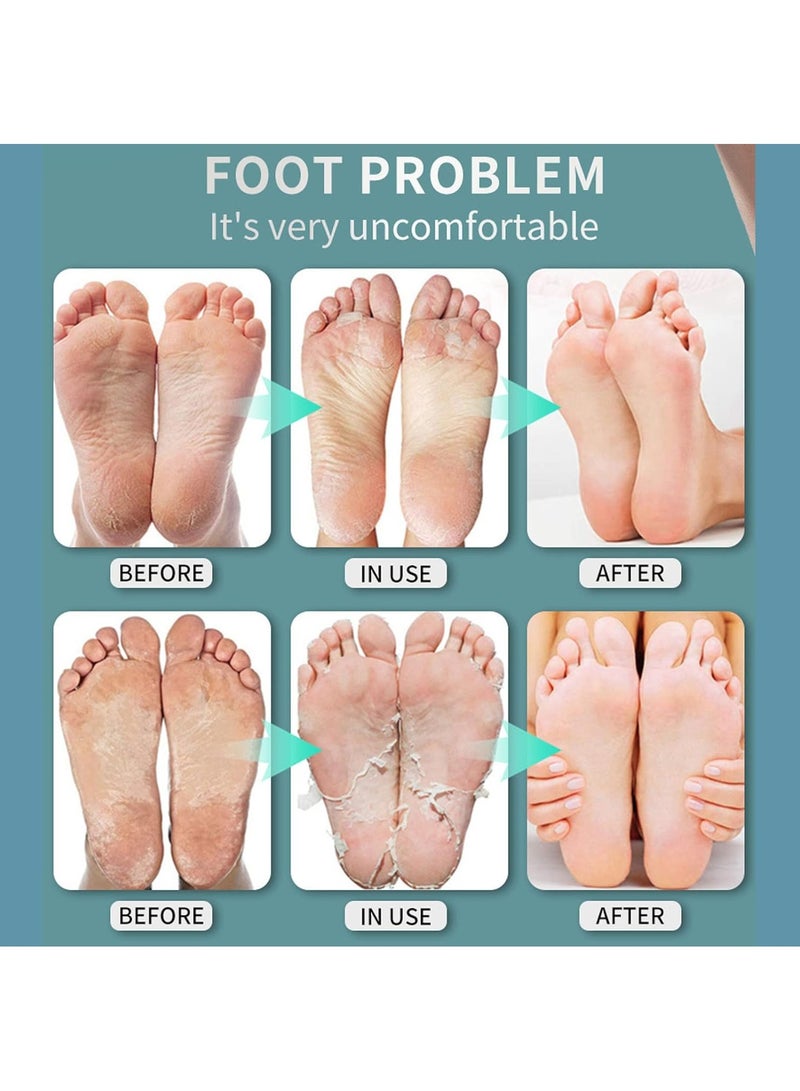 DubaiGallery 30ml Foot Herbal Shoe Deodorant Spray Foot Odor Shoe Odor Nemesis Odor Removal Artifact Foot Spray - Image 3