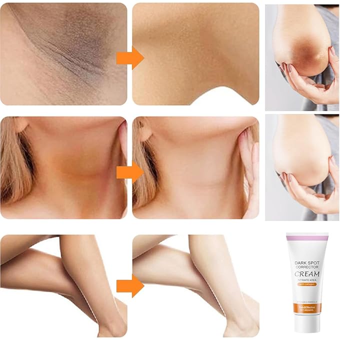 paminify Dark Spot Corrector Cream,Dark Spot Remover for Face and Body with Collagen,Niacinamide,Intimate Areas and Bleaching,Neck,Underarm,Elbow,Inner Thigh and Knees,Bikini Line,Instant Result,2 oz - Image 2