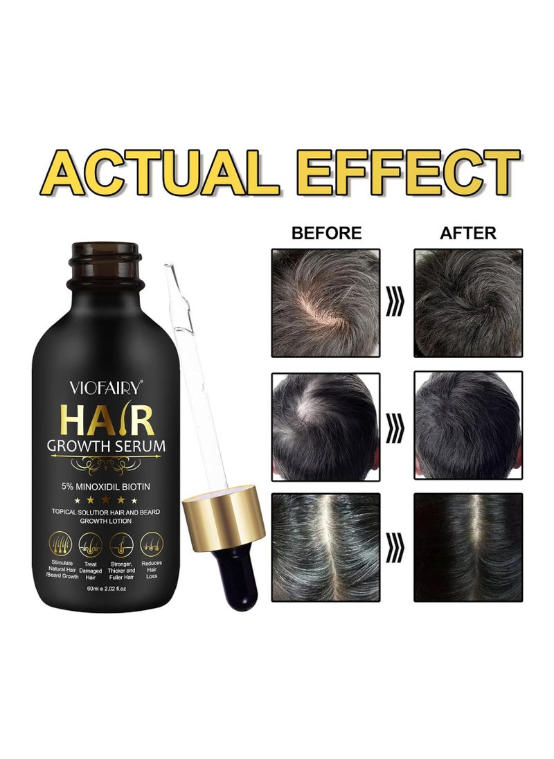 VIOFAIRY - 5% Minoxidil for Men and Women Hair Growth Oil, Biotin Serum, Hair Regrowth Treatment for Scalp Hair Loss, Natural, for Thicker Longer Fuller Healthier Hair 2.02 oz - Image 1