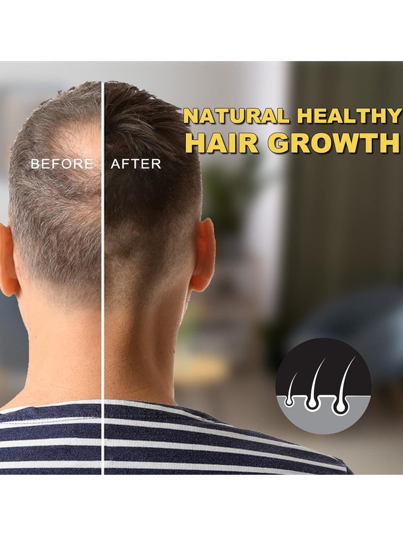 VIOFAIRY - 5% Minoxidil for Men and Women Hair Growth Oil, Biotin Serum, Hair Regrowth Treatment for Scalp Hair Loss, Natural, for Thicker Longer Fuller Healthier Hair 2.02 oz - Image 1