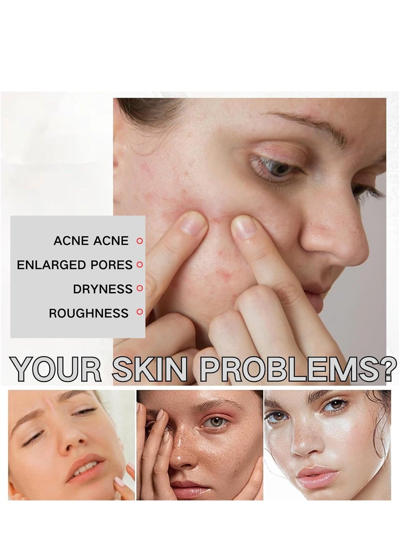 إيلهو منظف رغوي جليكوليبيد للبشرة الدهنية ، رغوة منظف للوجه ، غسول للوجه لجميع أنواع البشرة ، منظف لطيف للوجه للبشرة المعرضة لحب الشباب ، يزيل الشوائب ، ترطيب البشرة المهدئة 100 غرام - Image 2