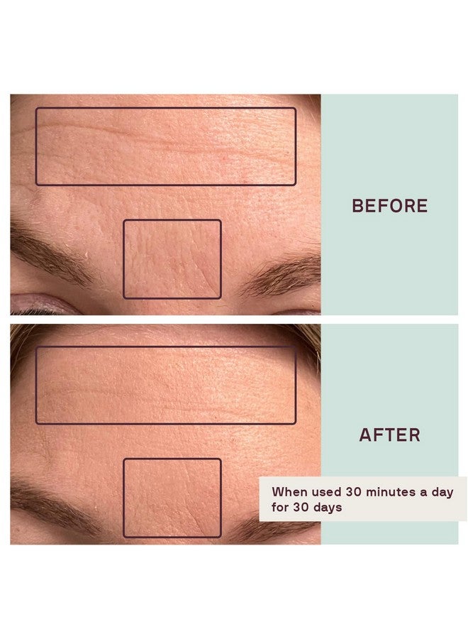 Dermaclara Face To Face Bundle Includes 4 Eyes & Mouth Occlusion Patches 1 Forehead Occlusion Patch 1 Patch Prep And 1 7 Ml Peptide Infused Lip Serum Complete Silicone Face Patches Kit - Image 3